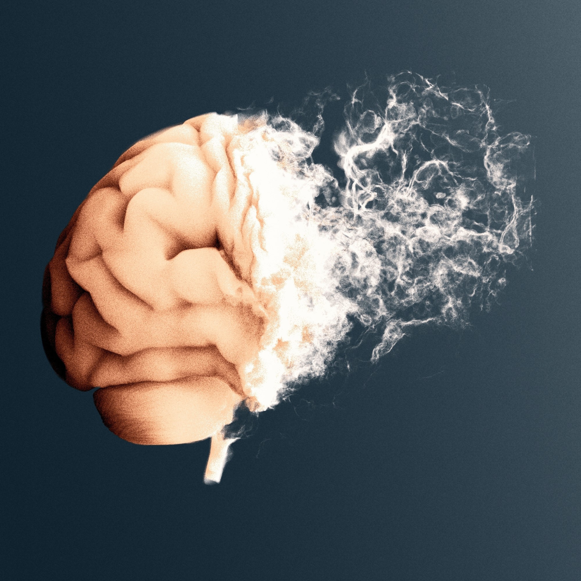 Novas descobertas do The Neuro e Douglas Research Centre podem explicar mudanças cerebrais do Alzheimer. Revela novos detalhes sobre como o acúmulo de proteínas