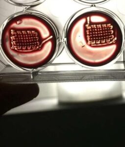 Ossos quebrados poderão ser recuperados com implante de sangue, mostram cientistas da Universidade de Nottingham