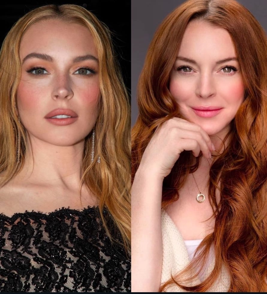 Novo rosto de Lindsay Lohan intriga fãs: médico brasileiro que criou técnica explica transformação