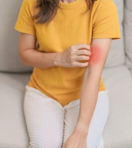 Lúpus: pesquisa busca voluntários para testar medicamento