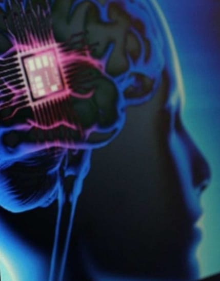 Neuralink vai testar chip cerebral para controlar braço robótico