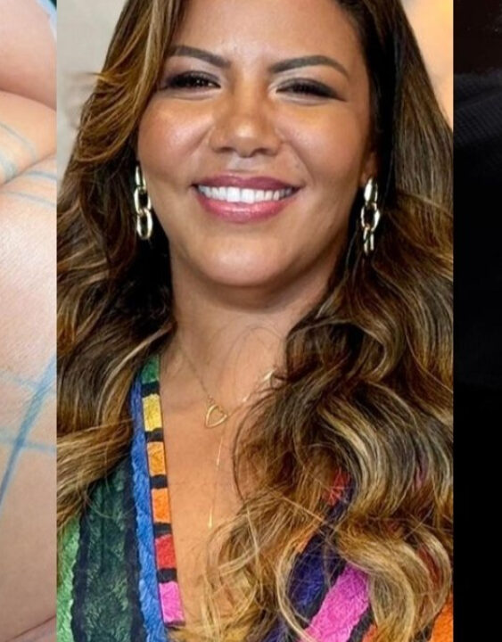 Confira o antes e depois de Mani Rego após as cirurgias plásticas; VEJA VÍDEO