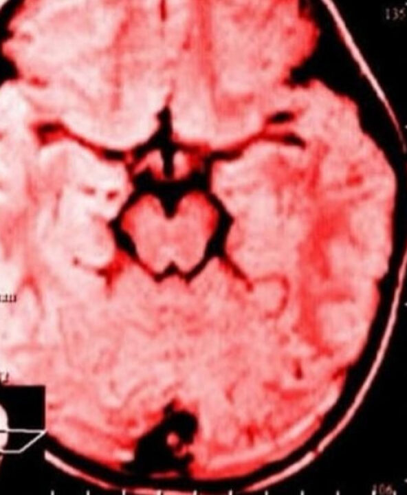 A ciência explica como hábito de reclamar adoece nosso cérebro