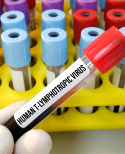 HTLV: conheça o primo distante do HIV e os seus perigos para a saúde