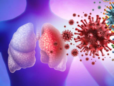 Nova IA pode diferenciar pneumonia de Covid-19