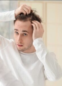 Uso de minoxidil por adultos e  casos de aparecimento de pelos em áreas incomuns, como rosto, costas e mãos de bebês