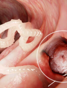 A queimação na perna causada por uma ‘surpresinha’ no cérebro; ENTENDA