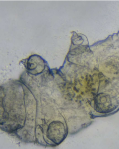 Proteína de tardígrados pode ser chave para proteger pacientes da radioterapia
