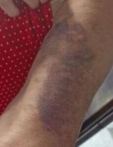 Família de aluno agride professora após cobrança de dever de casa