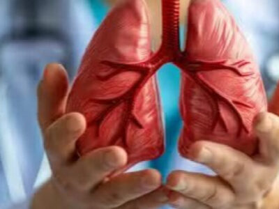 Excesso de açúcar no sangue pode aumentar risco de câncer no pulmão; ENTENDA