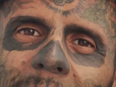 ‘Homem mais tatuado do Brasil’ exibe rosto após passar por sessão de remoção a laser
