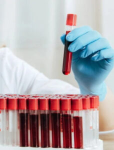 Seu sangue pode esconder o segredo da longevidade — veja se é o seu tipo!