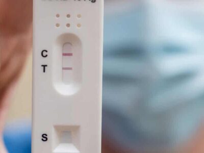 Estudo reforça: Covid-19 não saiu de laboratório