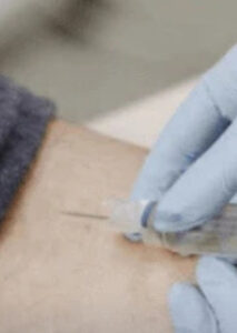 Exame de sangue pode detectar câncer três anos antes, afirmam cientistas