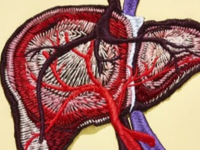 DESCOBERTA: Vitamina D pode frear progressão da doença hepática crônica, indica estudo; VEJA VÍDEO
