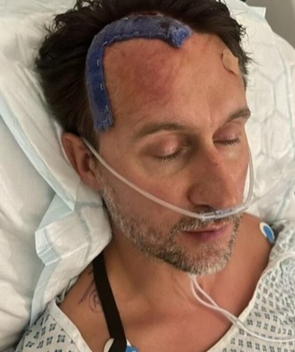 Homem descobre câncer após atribuir enxaquecas ao estresse da rotina