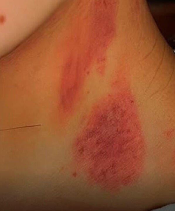 INUSITADO: Esposa aparece com marcas no pescoço e diz ter sido atacada por lobisomem