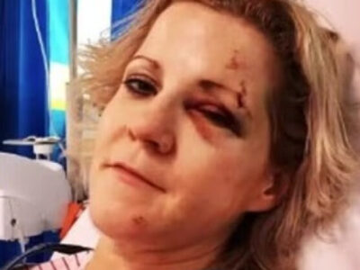 Sete vidas? Mulher que driblou a morte várias vezes diz não temer mais o fim