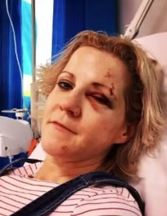 Sete vidas? Mulher que driblou a morte várias vezes diz não temer mais o fim