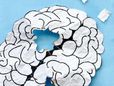 Estudo identifica 4 padrões de saúde que podem prever o Alzheimer