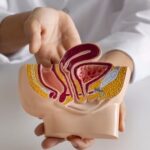 Presente em cerca de 15% a 25% dos homens jovens, saiba por que devem se preocupar com a varicocele. Saiba mais com urologista do Albert Einstein