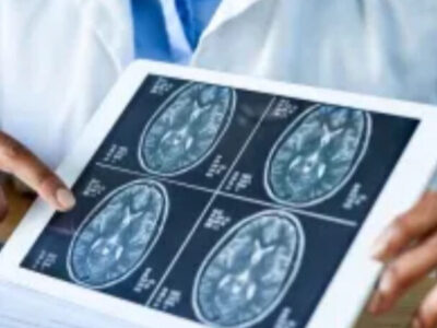 Anvisa aprova novo medicamento para tumor no cérebro; veja como funciona
