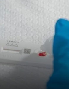 Estudo aponta que 1 a cada 50 pessoas tem HIV na região metropolitana de saúde do RS