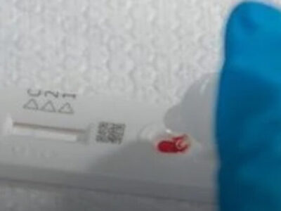 Estudo aponta que 1 a cada 50 pessoas tem HIV na região metropolitana de saúde do RS