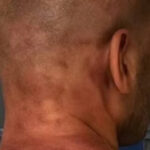 Veja foto de ex-jogador agredido na prisão após dar 61 socos em mulher