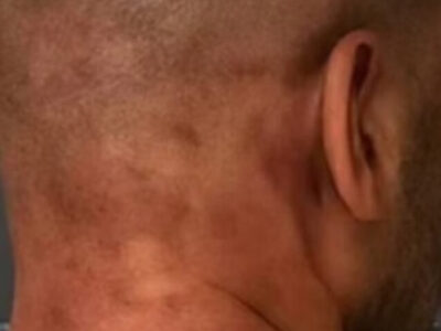 Veja foto de ex-jogador agredido na prisão após dar 61 socos em mulher