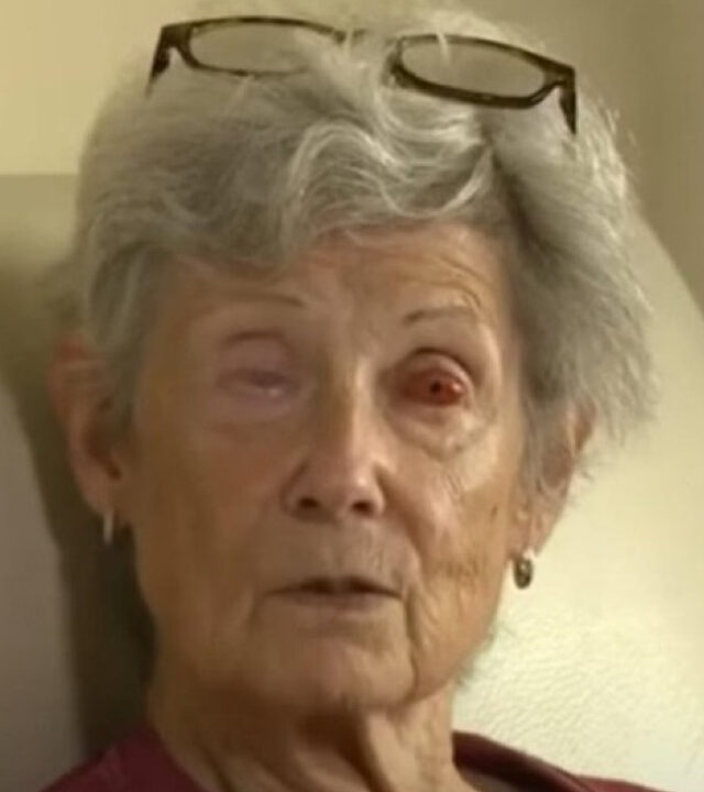 Mulher recupera visão após cirurgia com implante de dente no olho