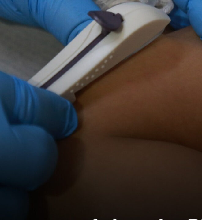 Prefeito do PT disponibiliza contraceptivos para crianças
