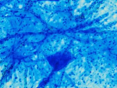 Psicoterapia provoca mudanças estruturais no cérebro, aponta estudo