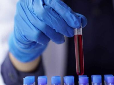 Pesquisadores descobrem possível elo entre sangue e rejuvenescimento
