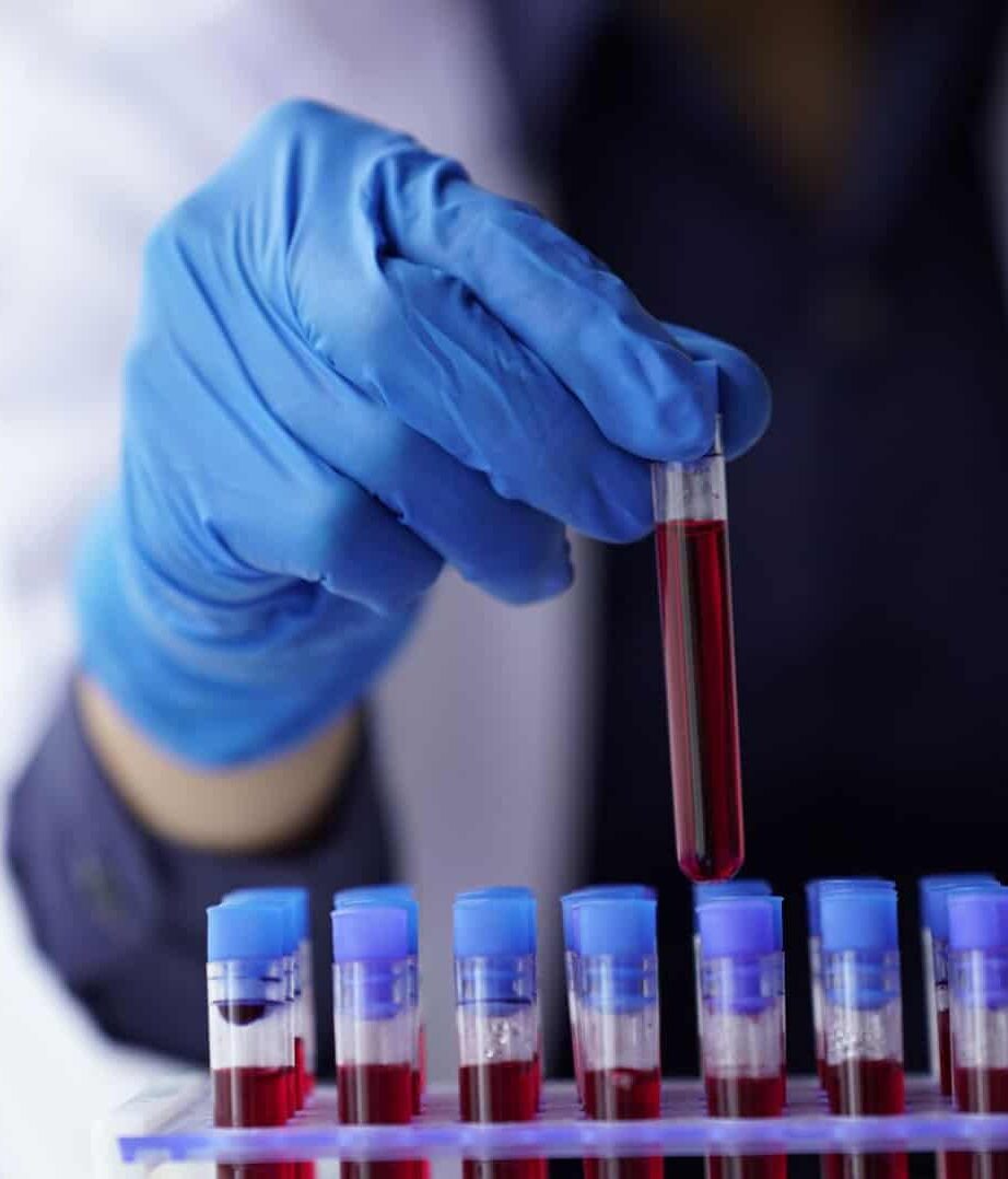 Pesquisadores descobrem possível elo entre sangue e rejuvenescimento