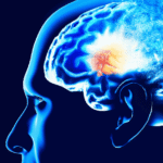 Este pode ser um dos primeiros sinais do Alzheimer, segundo pesquisa
