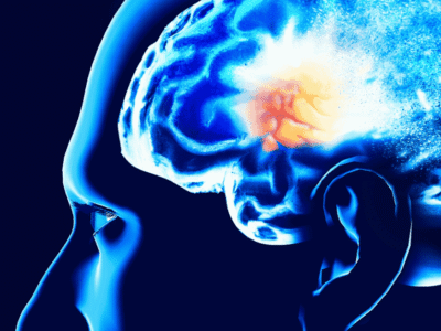 Este pode ser um dos primeiros sinais do Alzheimer, segundo pesquisa