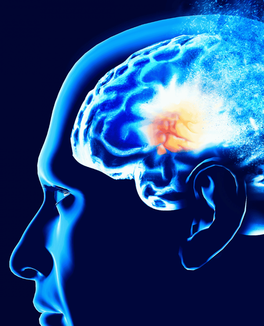 Este pode ser um dos primeiros sinais do Alzheimer, segundo pesquisa