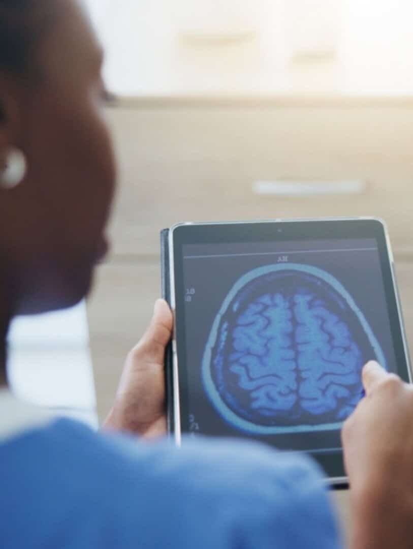 5 mitos sobre o Alzheimer que você ainda acredita