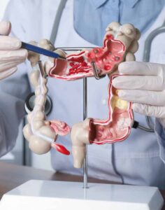 Estes hábitos podem reduzir em até 30% o risco de câncer de intestino