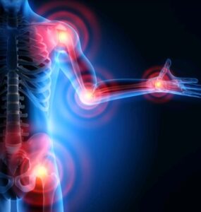 Implante no pescoço promete mudar tratamento da artrite reumatoide. Dispositivo de neuromodulação estimula o nervo vago para modular a resposta imunológica e beneficiar milhões de pessoas