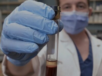 Novo exame de sangue detecta 10 anos antes câncer de cabeça e pescoço associado ao HPV. Identifica a doença antes que os sintomas apareçam. Há vacina