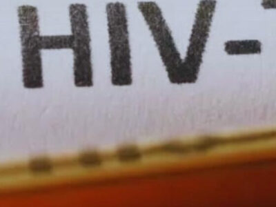 ERRO GROTESCO: prefeitura publica lista com nomes de 600 pessoas que vivem com HIV