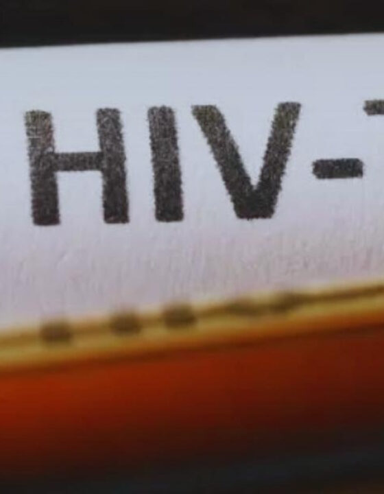 ERRO GROTESCO: prefeitura publica lista com nomes de 600 pessoas que vivem com HIV