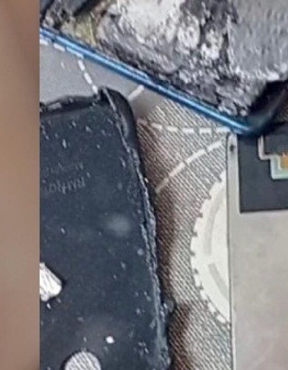 Criança de 10 anos sofre queimaduras após celular pegar fogo