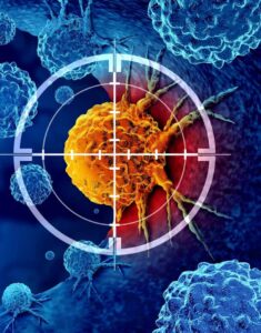 Descoberta pode revolucionar combate ao câncer de pâncreas