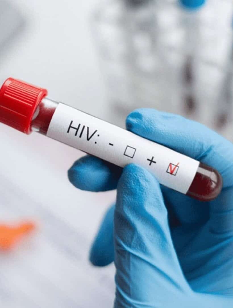 SUS pode oferecer terapia injetável contra o HIV