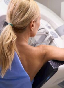 Mamografia agora deve ser realizada partir dos 40 anos