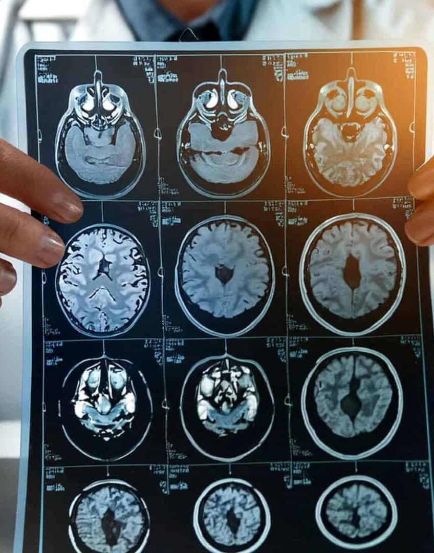 Estudo mostra que o autismo tem múltiplas origens — e isso muda como devemos entendê-lo