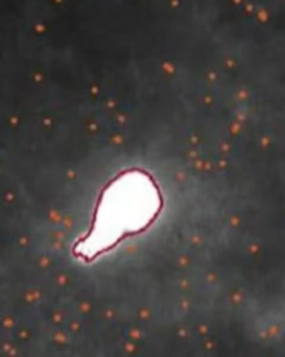 Saiba como surgem os primeiros gatilhos da doença de Parkinson